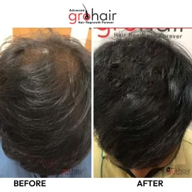 Hair Transformation 10