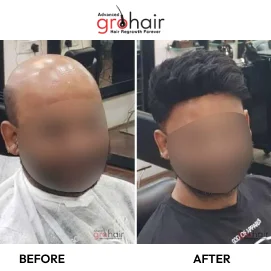 Hair Transformation 8